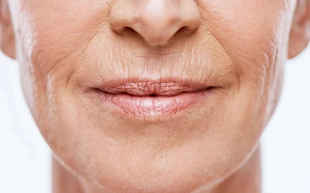 Rajeunissement des lèvres