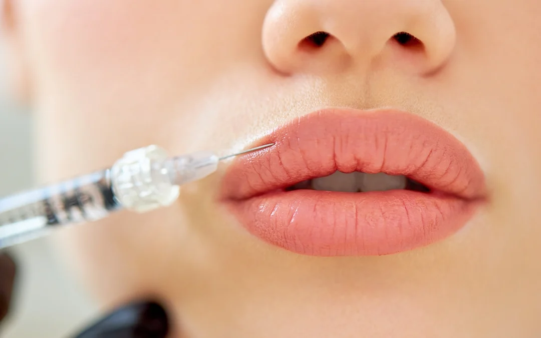 Augmentation des lèvres